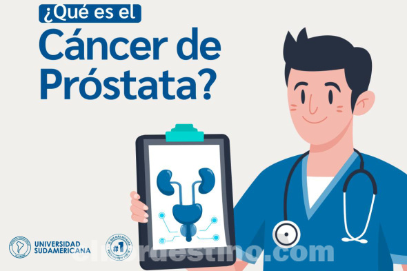 Para Diagnóstico Precoz, Universidad Sudamericana recomienda controles y comparte Signos de Alarma del Cáncer de Próstata